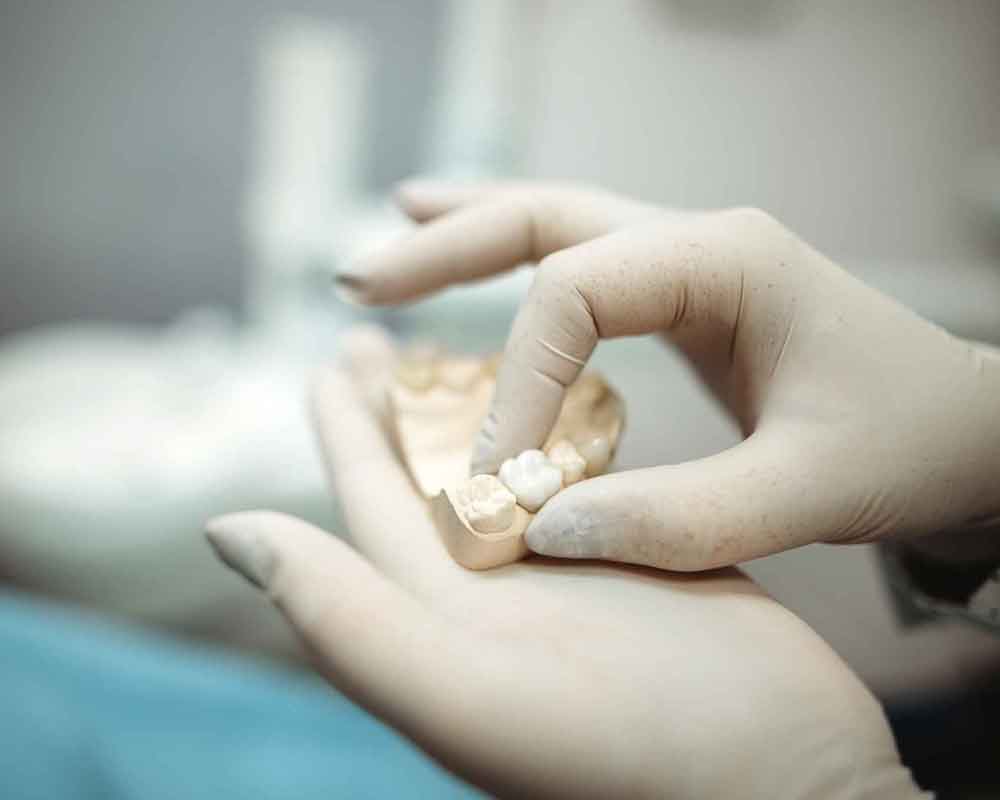 NY central square smiles implant restorations candidates